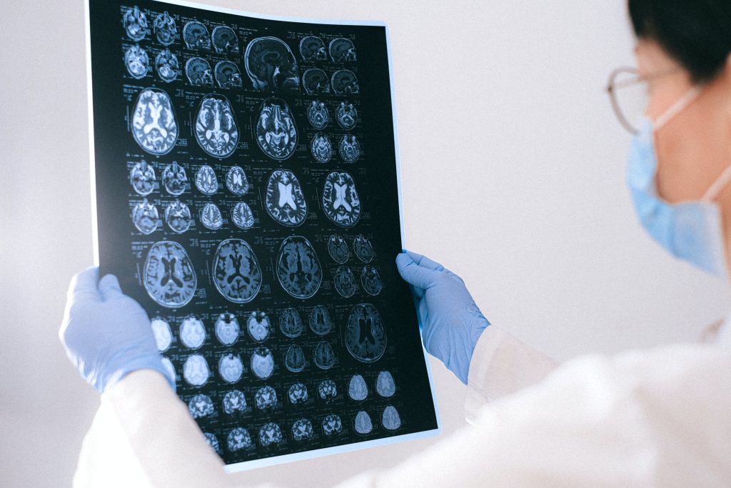 Vision training and brain plasticity