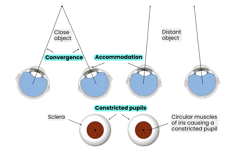 Diagram showing convergence and accommodation when focusing on a close object, with inward eye movement and constricted pupils compared to distance viewing.