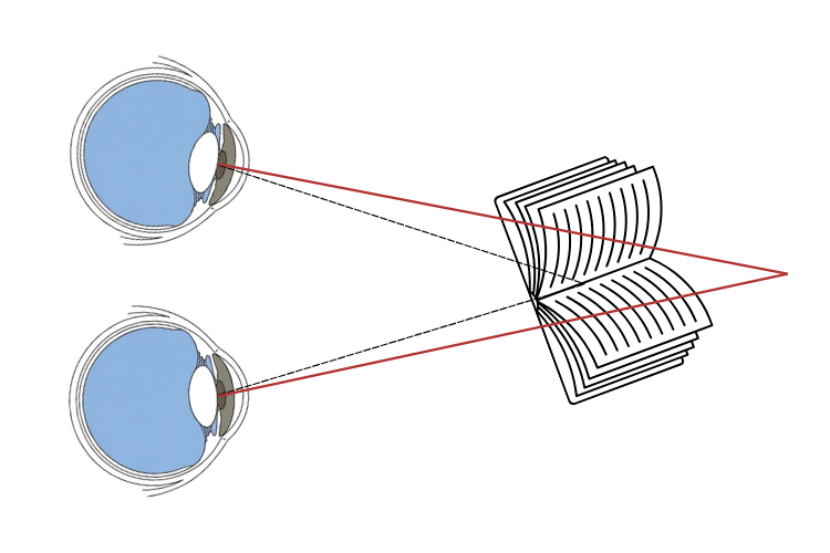 Schematic showing the eyes under-converging on a near reading target, with the visual axes intersecting beyond the target.
